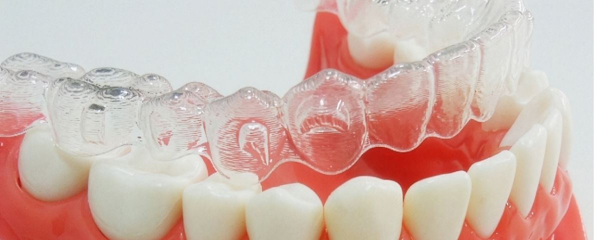 マウスピース型矯正装置（インビザライン）